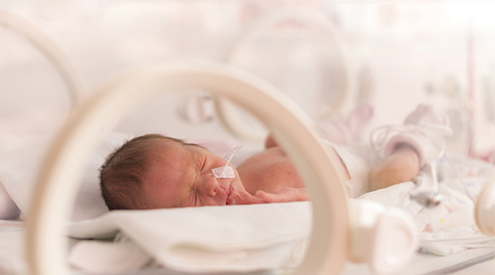 Taranan Her 4 Bebeğin Birinde Görülüyor : Prematüre Retinopatisi (ROP)