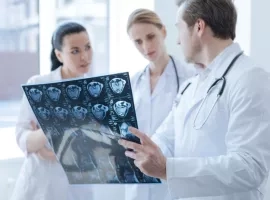 Beyin Sağlığı Yaşla Değil, Yaşam Tarzıyla Belirleniyor!