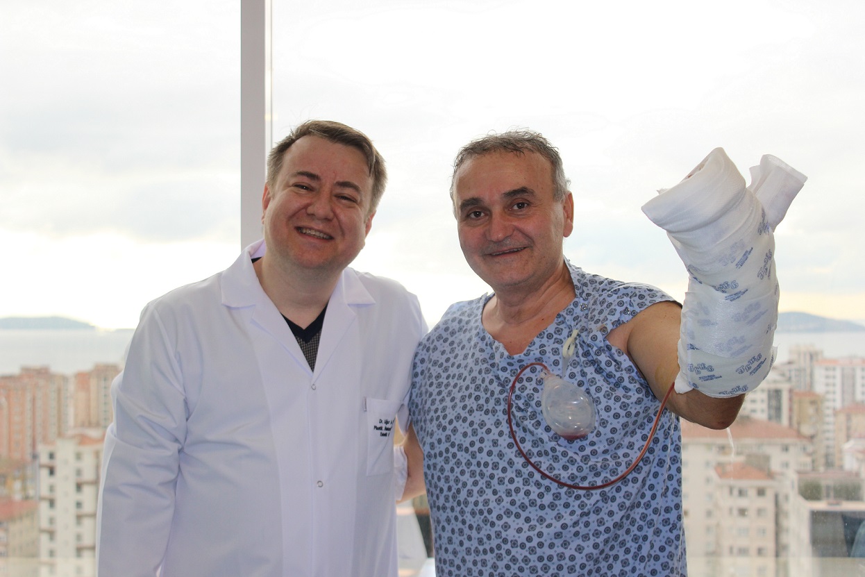 Turkish Doctors Saved The Finger Which Was Said To Require Amputation In Germany And Bulgaria